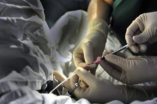 一般美國試管嬰兒成功率是多少