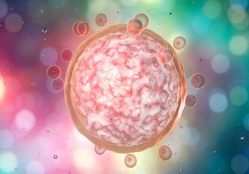 做美國(guó)做試管要多少錢