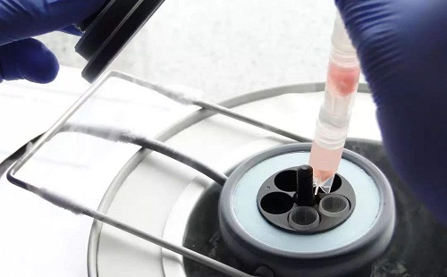 第二代試管嬰兒的價(jià)格問題